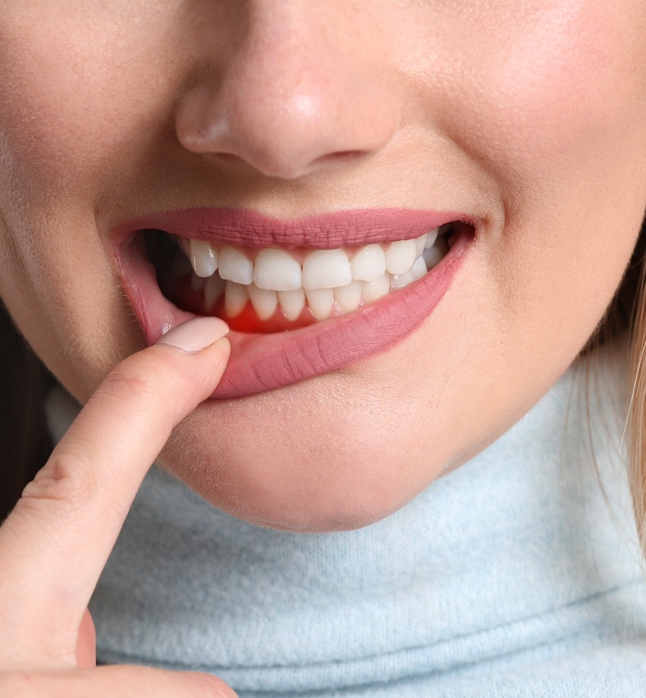 Woman with gum inflammation, closeup