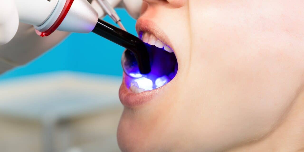 Dental Bonding Cost: Save With These Expert Tips