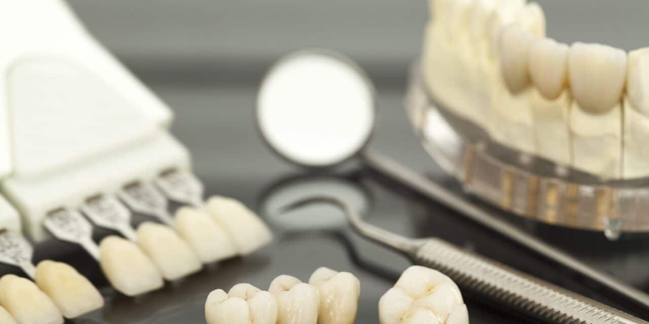 When Can You Eat After a Dental Bridge? A Recovery Timeline
